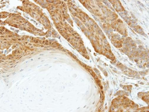 heat shock protein family A (Hsp70) member 6 Antibody