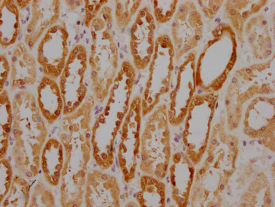 HSPA8 Monoclonal Antibody