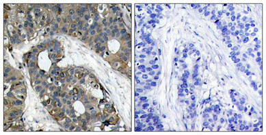 HSPB1 (Ab-82) Antibody