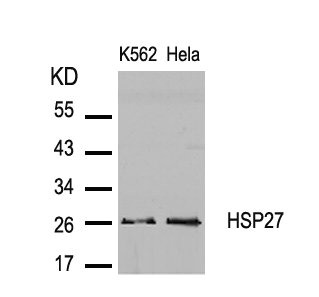 HSPB1 (Ab-82) Antibody