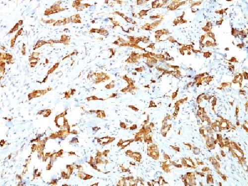 HSPB1 Antibody