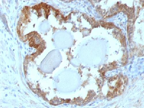 HSPB1 Antibody
