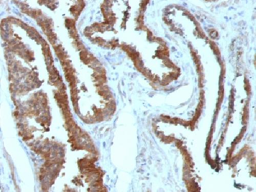 HSPB1 Antibody