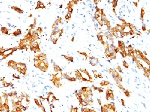 HSPB1 Antibody