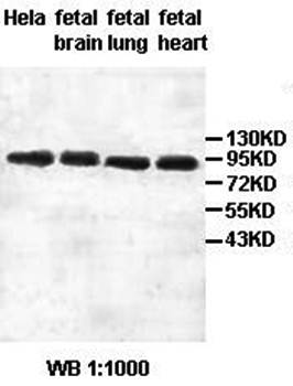 HSPH1 Rabbit Polyclonal Antibody
