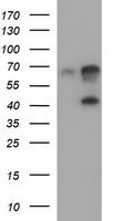 TRMT2A Antibody