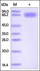 Human Axl Protein, His Tag