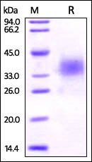 Human B7-H5 Protein, His Tag