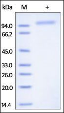 Human Cadherin-6 Protein, His Tag