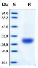 Human Carbonic Anhydrase II Protein, His Tag