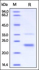 Human CD160 Protein, His Tag