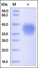Human CD48 Protein, His Tag