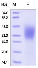 Human CD58 Protein, His Tag