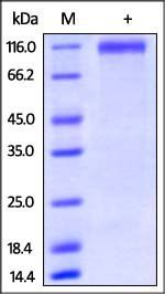 Human P-Selectin Protein, His Tag