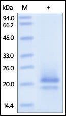 Human CD83 Protein, His Tag
