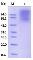 Human CEACAM-1 Protein, His Tag