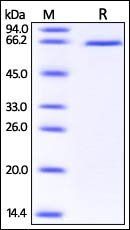 Human DLL1 Protein, His Tag