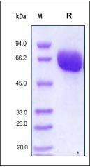 Human EphB4 Protein, His Tag