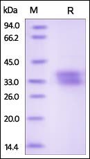 Human Ephrin-B1 Protein, His Tag