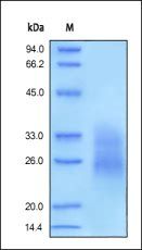 Human Fas Protein, His Tag