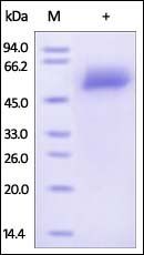 Human Fetuin A Protein, His Tag