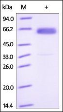 Human Frizzled-4 Protein, Fc Tag