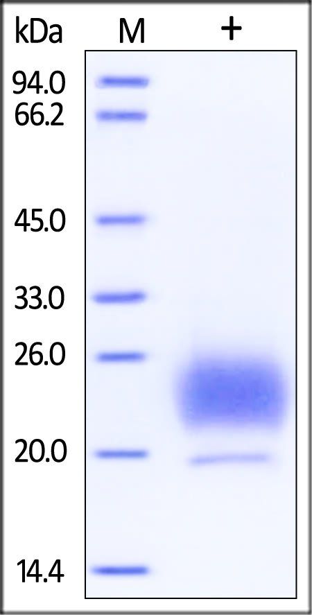 Human HE4 Protein, His Tag