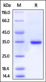 Human IgG1 Fc Protein, His Tag