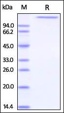 Human Jagged 1 Protein, His Tag