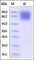 Human LAMP1 Protein, His Tag