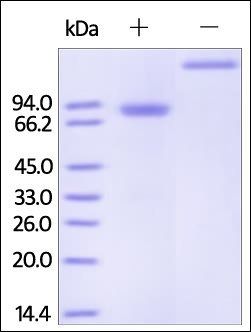 Human Osteoprotegerin Protein, Fc Tag