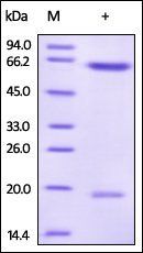 Human PCSK9 Protein, His Tag