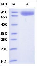 Human pIgR Protein, His Tag