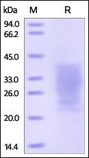 Human PTH1R Protein, His Tag