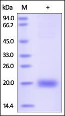 Human SECTM1 Protein, His Tag