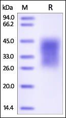 Human TIM-3 Protein, His Tag