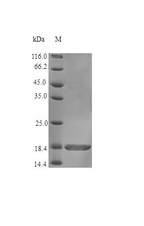 Human TR13B protein (Active)