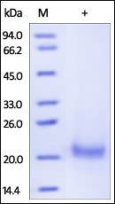Human TRAIL R1 Protein, His Tag