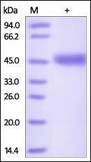Human VSIG4 Protein, His Tag