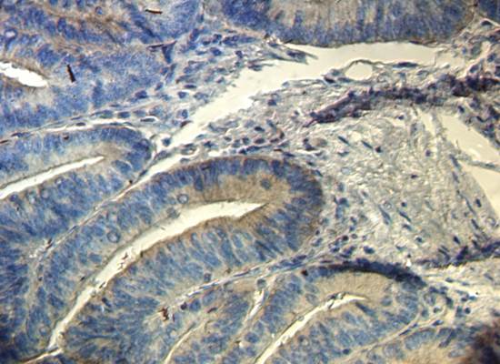 CD133 antibody