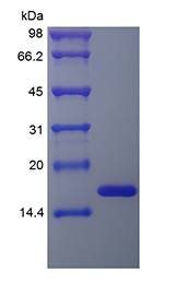 Human FGF basic protein