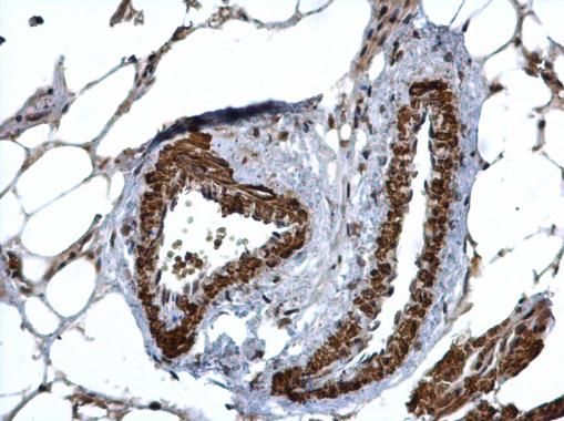 HUS1 Rabbit Polyclonal Antibody
