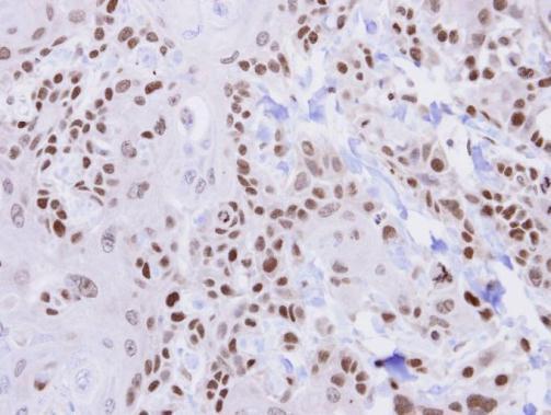 HUS1 Rabbit Polyclonal Antibody