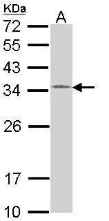 HUS1 Rabbit Polyclonal Antibody