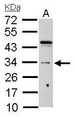 HUS1 Rabbit Polyclonal Antibody
