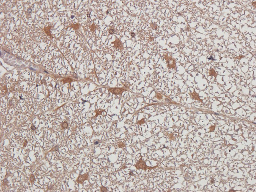 HXB2 Rabbit Polyclonal Antibody