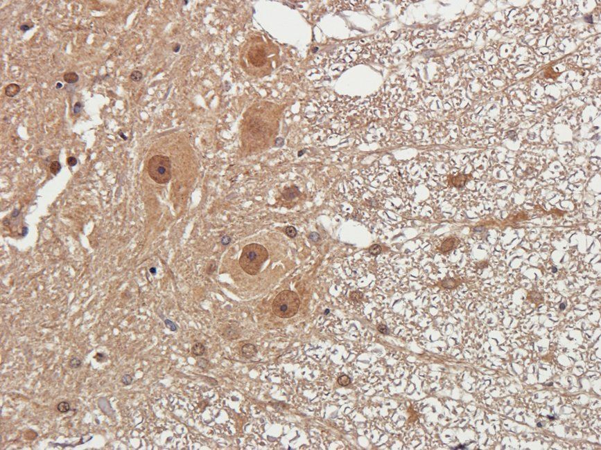 HXB2 Rabbit Polyclonal Antibody