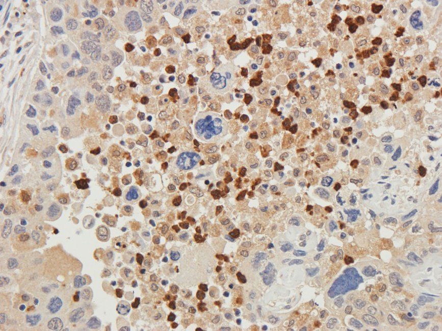 HXB2 Rabbit Polyclonal Antibody