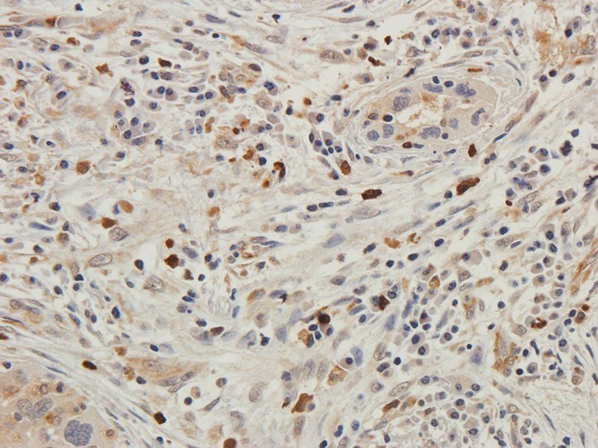 HXB2 Rabbit Polyclonal Antibody