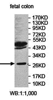 HYI Rabbit Polyclonal Antibody